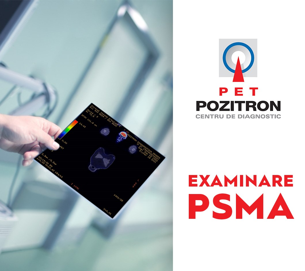 Examinarea PET-PSMA
